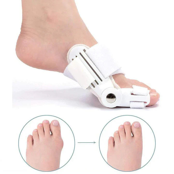 Hallux-Valgus - Korrekturschiene (1 Paar)