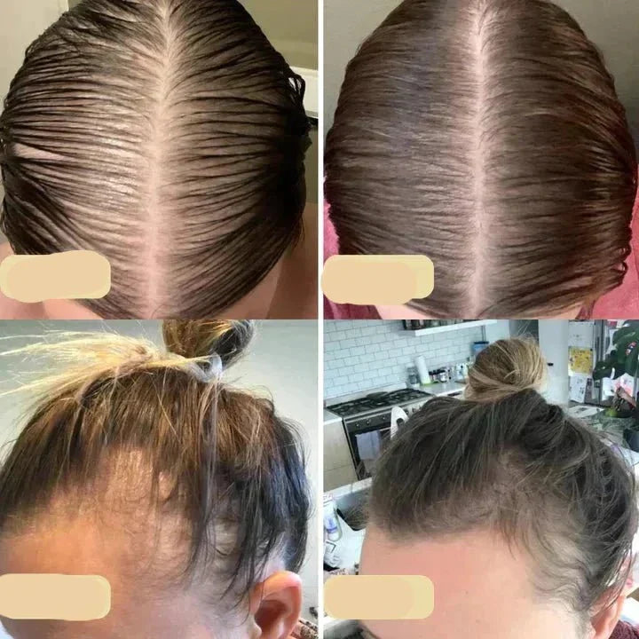 Veganes Haarwuchsöl | Natürlicher Booster Für Gesundes Haarwachstum