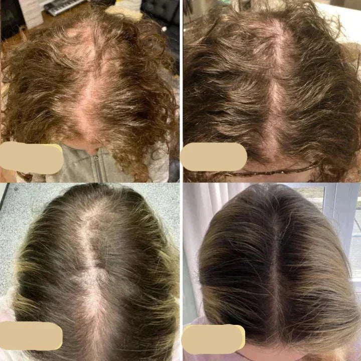 Veganes Haarwuchsöl | Natürlicher Booster Für Gesundes Haarwachstum