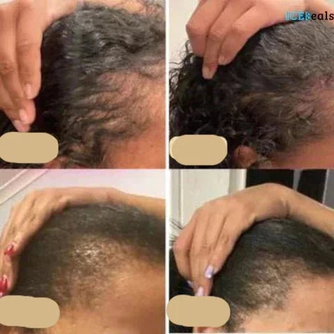Veganes Haarwuchsöl | Natürlicher Booster Für Gesundes Haarwachstum