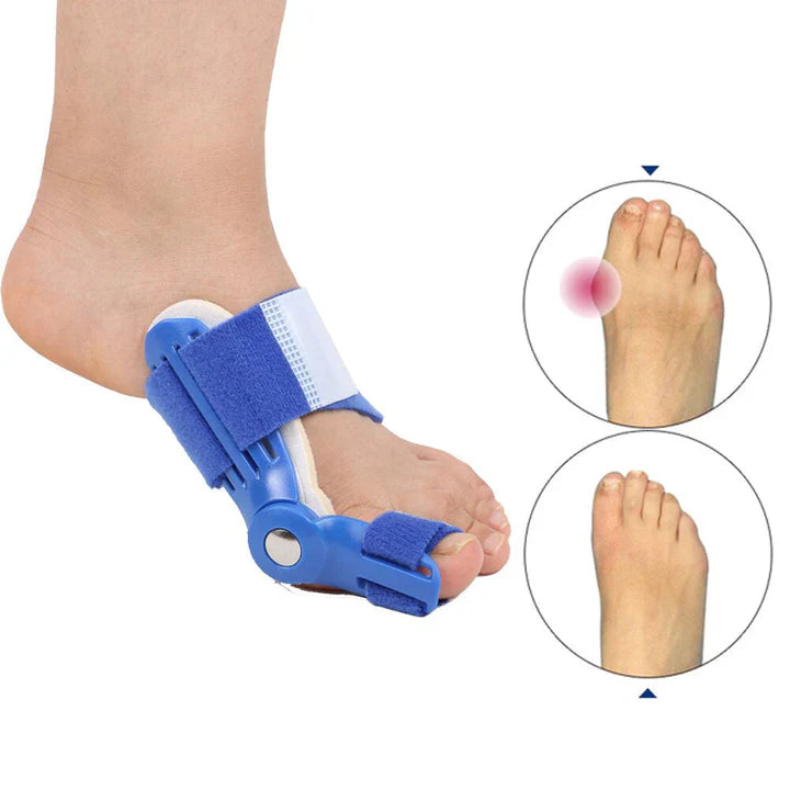 Hallux-Valgus - Korrekturschiene (1 Paar)