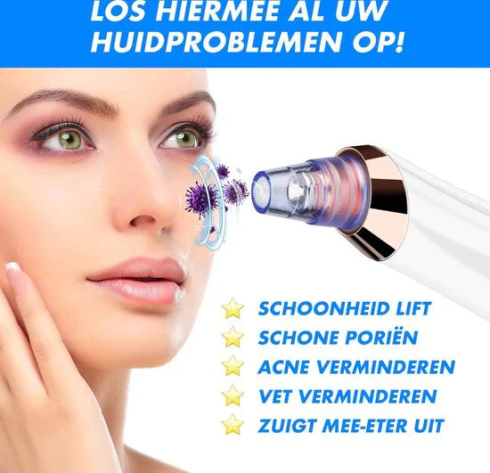 Elektrischer Mitesser Entferner